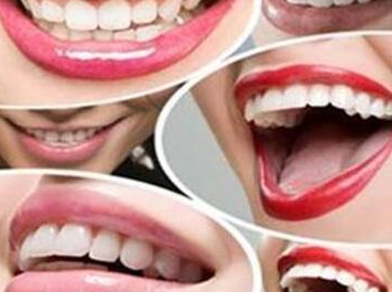 导致牙颌畸形的不良习惯有哪些 | 义齿厂家