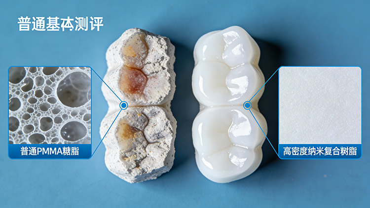 义齿发黄、松动、有异味？成都义齿厂家解析三大问题根源与应对方案